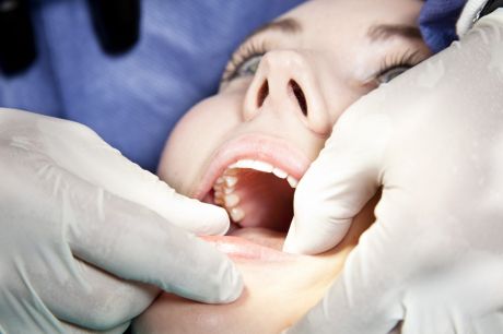 Prawdy i mity na temat implantów stomatologicznych