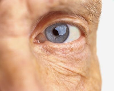 Jak odmłodzić starzejące się oko